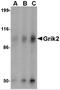 Glutamate Ionotropic Receptor Kainate Type Subunit 2 antibody, 4387, ProSci, Western Blot image 