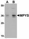 Transmembrane Protein 173 antibody, LS-C108557, Lifespan Biosciences, Western Blot image 