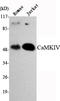 Calcium/Calmodulin Dependent Protein Kinase IV antibody, STJ98474, St John