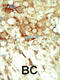 Ret Proto-Oncogene antibody, 63-127, ProSci, Immunohistochemistry paraffin image 