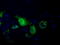 Pantothenate Kinase 2 antibody, M02776, Boster Biological Technology, Immunofluorescence image 