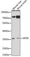 Apolipoprotein E antibody, 16-562, ProSci, Western Blot image 