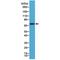 PLAP-1 antibody, M01718-1, Boster Biological Technology, Western Blot image 