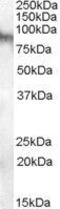 Neuroligin 3 antibody, PA5-18849, Invitrogen Antibodies, Western Blot image 