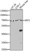 Interferon Induced Protein With Tetratricopeptide Repeats 3 antibody, A14004, ABclonal Technology, Western Blot image 