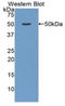 Alpha-1-acid glycoprotein 1 antibody, LS-C292723, Lifespan Biosciences, Western Blot image 