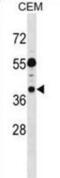 EARP Complex And GARP Complex Interacting Protein 1 antibody, abx029145, Abbexa, Western Blot image 