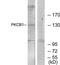Zinc Finger MYND-Type Containing 8 antibody, TA315262, Origene, Western Blot image 