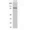 Lysine Acetyltransferase 2B antibody, LS-C385381, Lifespan Biosciences, Western Blot image 