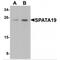 Spermatogenesis Associated 19 antibody, MBS150919, MyBioSource, Western Blot image 