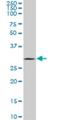 Uncoupling Protein 1 antibody, H00007350-M03, Novus Biologicals, Western Blot image 