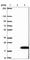 Fatty Acid Binding Protein 2 antibody, HPA034607, Atlas Antibodies, Western Blot image 