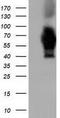 Adenylate Kinase 5 antibody, GTX84921, GeneTex, Western Blot image 