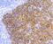 Keratin 5 antibody, NBP2-67586, Novus Biologicals, Immunohistochemistry paraffin image 