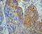 Matrix Metallopeptidase 1 antibody, ab52631, Abcam, Immunohistochemistry paraffin image 