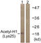 H1 Histone Family Member 0 antibody, LS-C120505, Lifespan Biosciences, Western Blot image 