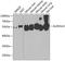 Aldehyde Dehydrogenase 1 Family Member A2 antibody, 22-990, ProSci, Western Blot image 