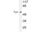 FYN Proto-Oncogene, Src Family Tyrosine Kinase antibody, LS-C177162, Lifespan Biosciences, Western Blot image 