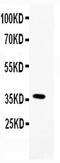 BGP antibody, PA5-78868, Invitrogen Antibodies, Western Blot image 