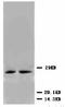 Cyclin Dependent Kinase Inhibitor 1B antibody, LS-C171816, Lifespan Biosciences, Western Blot image 