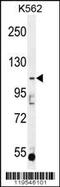 ATP/GTP Binding Protein Like 5 antibody, 56-039, ProSci, Western Blot image 