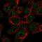 ATP Binding Cassette Subfamily G Member 5 antibody, NBP1-80712, Novus Biologicals, Immunofluorescence image 