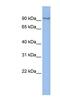 Transmembrane Protein 63B antibody, NBP1-91555, Novus Biologicals, Western Blot image 