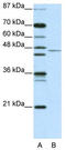 Tripartite motif-containing protein 14 antibody, TA338079, Origene, Western Blot image 