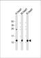 Phospholamban antibody, A01395, Boster Biological Technology, Western Blot image 
