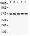 SMAD Family Member 6 antibody, PB9505, Boster Biological Technology, Western Blot image 