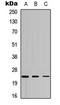 ATP Synthase Peripheral Stalk Subunit D antibody, LS-C358913, Lifespan Biosciences, Western Blot image 