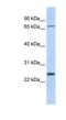 Zinc Finger Protein 835 antibody, NBP1-80200, Novus Biologicals, Western Blot image 