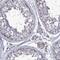 Tetratricopeptide Repeat Domain 23 antibody, HPA040369, Atlas Antibodies, Immunohistochemistry paraffin image 