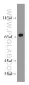 SELE antibody, 20894-1-AP, Proteintech Group, Western Blot image 