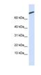 CAMP Regulated Phosphoprotein 21 antibody, NBP1-54394, Novus Biologicals, Western Blot image 