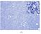 Thymidine Phosphorylase antibody, NB100-2737, Novus Biologicals, Immunohistochemistry frozen image 