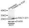 Rac Family Small GTPase 1 antibody, STJ22364, St John