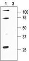 Potassium Calcium-Activated Channel Subfamily N Member 1 antibody, TA328945, Origene, Western Blot image 