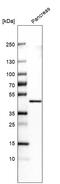 Carboxypeptidase A1 antibody, AMAb91433, Atlas Antibodies, Western Blot image 
