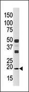 NME/NM23 Nucleoside Diphosphate Kinase 3 antibody, AP13799PU-N, Origene, Western Blot image 