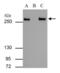 FAS antibody, PA5-22061, Invitrogen Antibodies, Immunoprecipitation image 