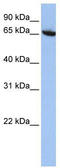 CBFA2/RUNX1 Partner Transcriptional Co-Repressor 2 antibody, TA343502, Origene, Western Blot image 