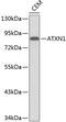 Ataxin 1 antibody, 13-189, ProSci, Western Blot image 