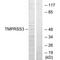 Transmembrane Serine Protease 3 antibody, PA5-49817, Invitrogen Antibodies, Western Blot image 