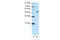 Forkhead Box A2 antibody, 29-075, ProSci, Enzyme Linked Immunosorbent Assay image 