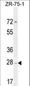 NADH:Ubiquinone Oxidoreductase Complex Assembly Factor 1 antibody, LS-C164802, Lifespan Biosciences, Western Blot image 