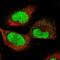 Epithelial Cell Transforming 2 antibody, NBP2-58392, Novus Biologicals, Immunocytochemistry image 