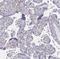 Ectonucleotide Pyrophosphatase/Phosphodiesterase 1 antibody, NBP2-38945, Novus Biologicals, Immunohistochemistry paraffin image 