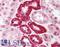 Small Ubiquitin Like Modifier 1 antibody, LS-B594, Lifespan Biosciences, Immunohistochemistry paraffin image 