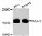 Rho Associated Coiled-Coil Containing Protein Kinase 1 antibody, abx125393, Abbexa, Western Blot image 